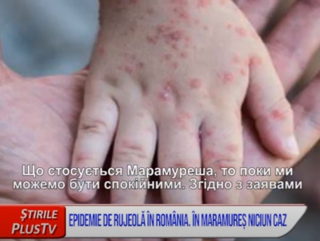 EPIDEMIE DE RUJEOLĂ ÎN ROMÂNIA. ÎN MARAMUREȘ NICIUN CAZ