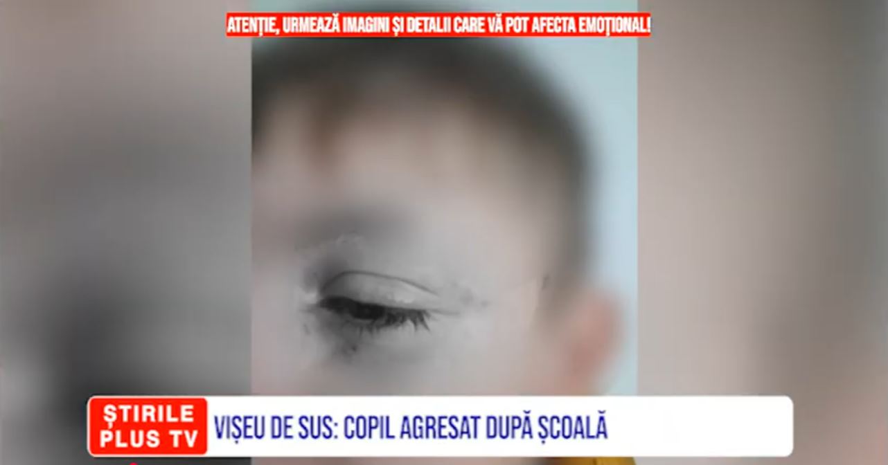 VIȘEU DE SUS: COPIL AGRESAT DUPĂ ȘCOALĂ
